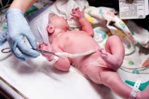 Baby attached to umbilical cord: All About Women Pregnancy and Prenatal Care blog