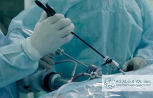 laparoscopic surgery explanation and benefits